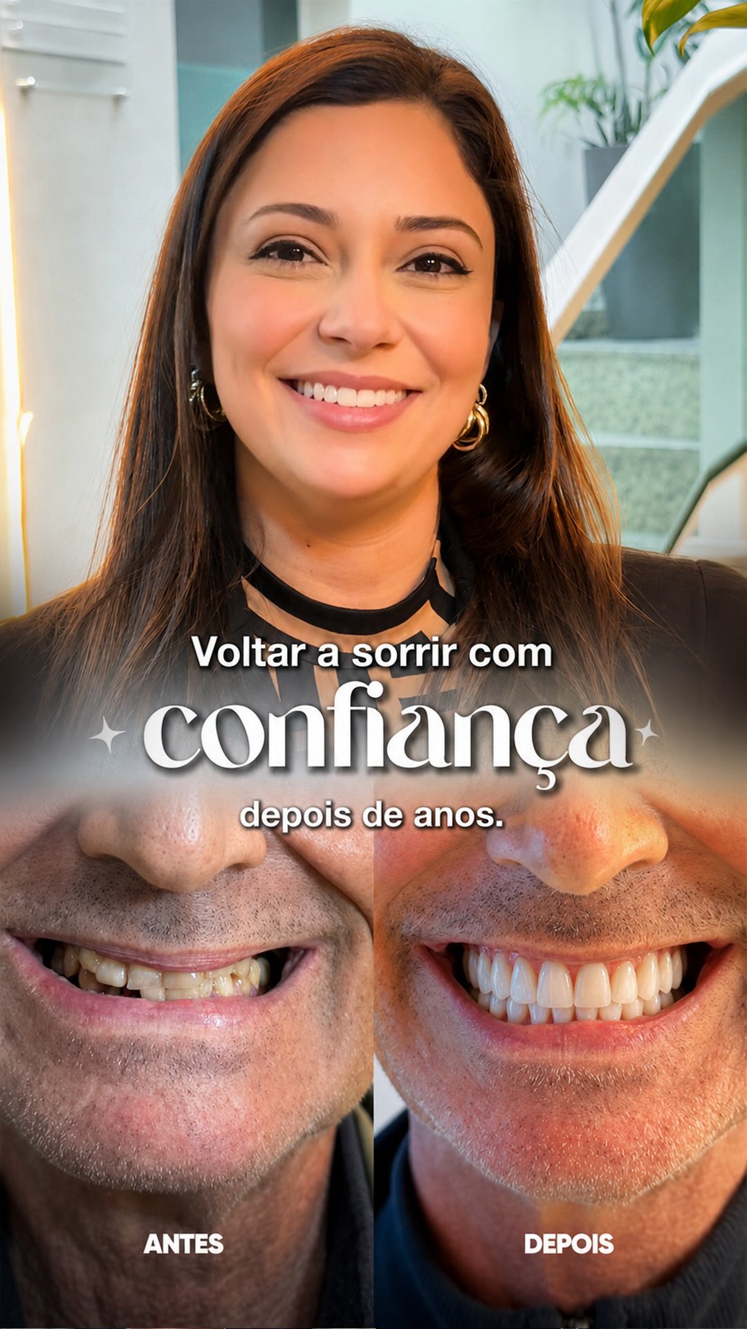 Reel: Voltar a sorrir com confiança — antes e depois de reabilitação oral